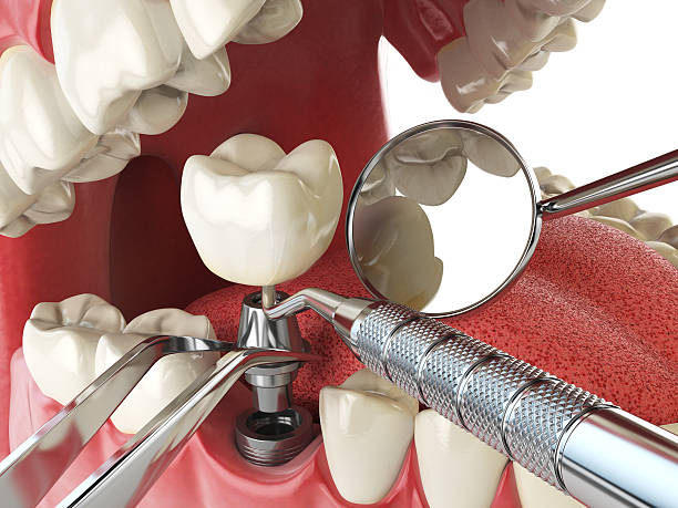 Best Urgent Tooth Repair  in Mcgregor, FL